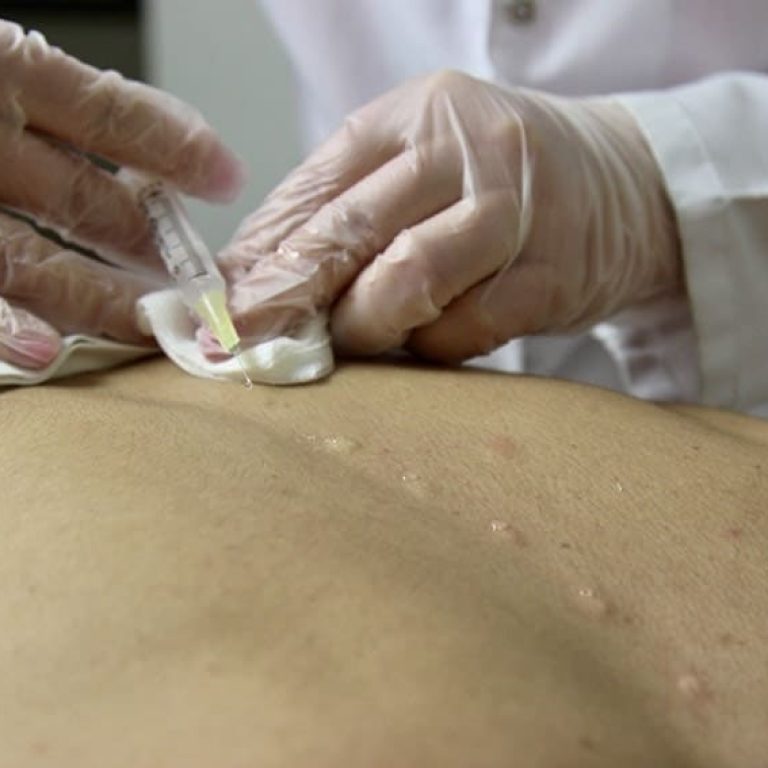 Tratamiento de Terapia Neural